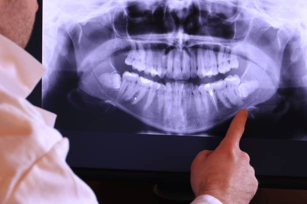 Best Emergency Root Canal Treatment in Prairie Grove, AR
